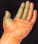 hand_surgery-1