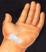 hand_surgery-2