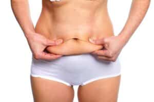 A close-up shot of a woman pinching the fat on her stomach before a tummy tuck procedure