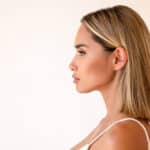 Side profile of a woman after chin implant surgery.