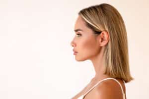 Side profile of a woman after chin implant surgery.